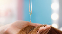 Przeszczep włosów - kiedy warto wykonać zabieg? Ile kosztuje przeszczep włosów?