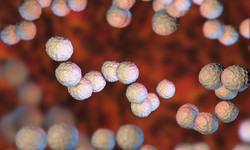 Streptococcus pyogenes - zakażenie, objawy, leczenie, powikłania