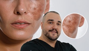 Dr Branislav Lukić, specijalista oftalmologije i lekar estetske medicine