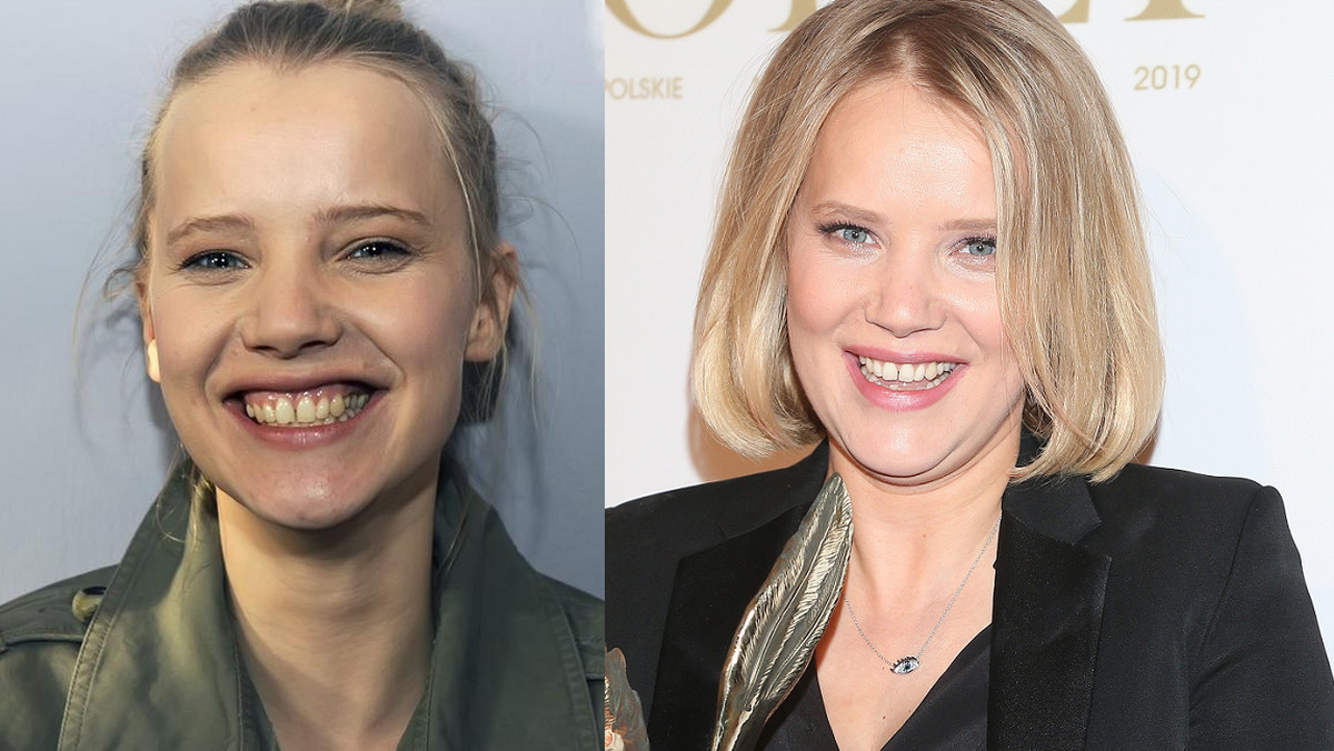 Joanna Kulig nie zawsze miała idealny, hollywoodzki uśmiech