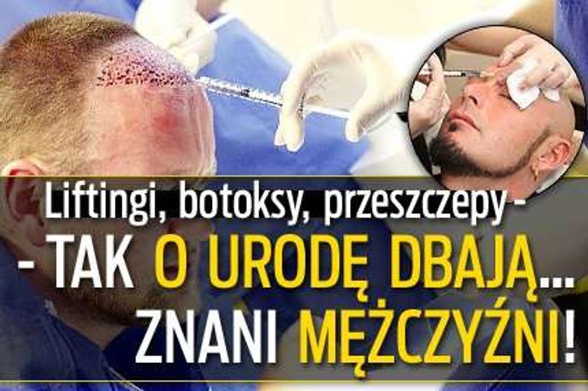 Botoksy, przeszczepy i liftingi. Tak znani faceci dbają o urodę!