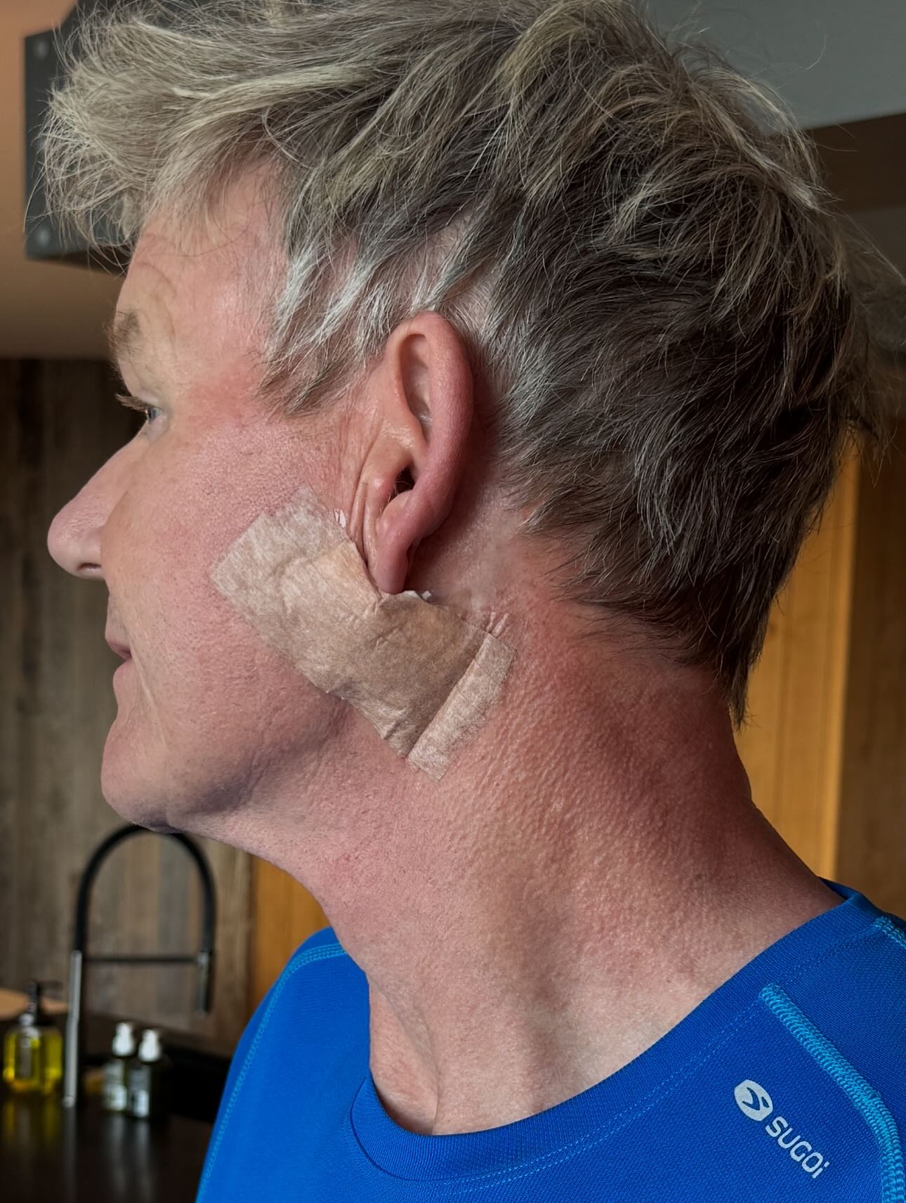 Britský šéfkuchár Gordon Ramsay podstúpil operáciu. 