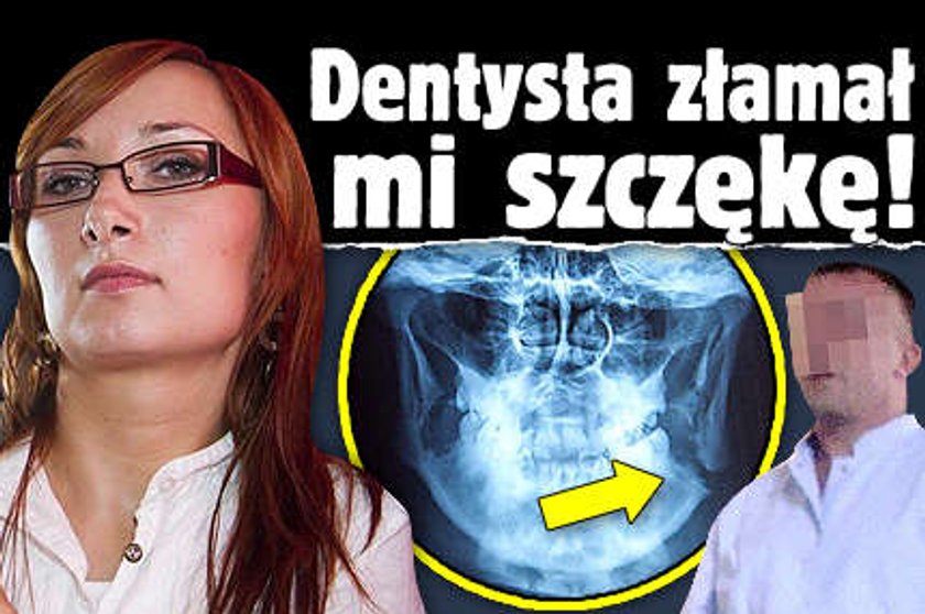 Dentysta złamał mi szczękę!