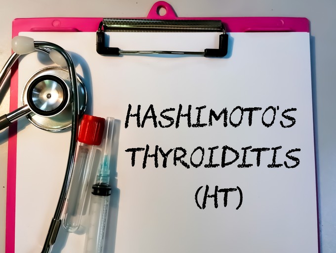 Hashimoto-betegség: tünetei, lefolyása, kezelése - orvosi válaszok a tévhitekre
