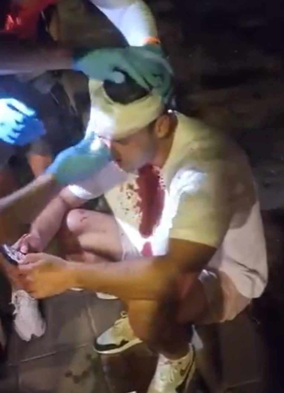 Povređen poslanik SSP