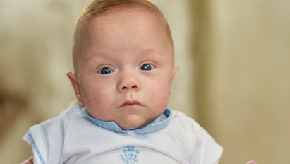 340 grammal jött világra, de mára egyre erősebb Anglia legkisebb babája