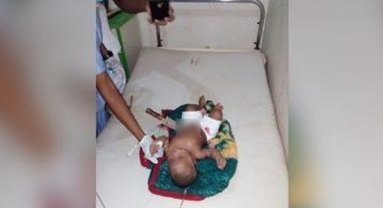 The eight-month-old baby pictured with the knife sticking out of his stomach