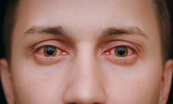 Cztery najczęstsze infekcje oczu, których nie możesz bagatelizować