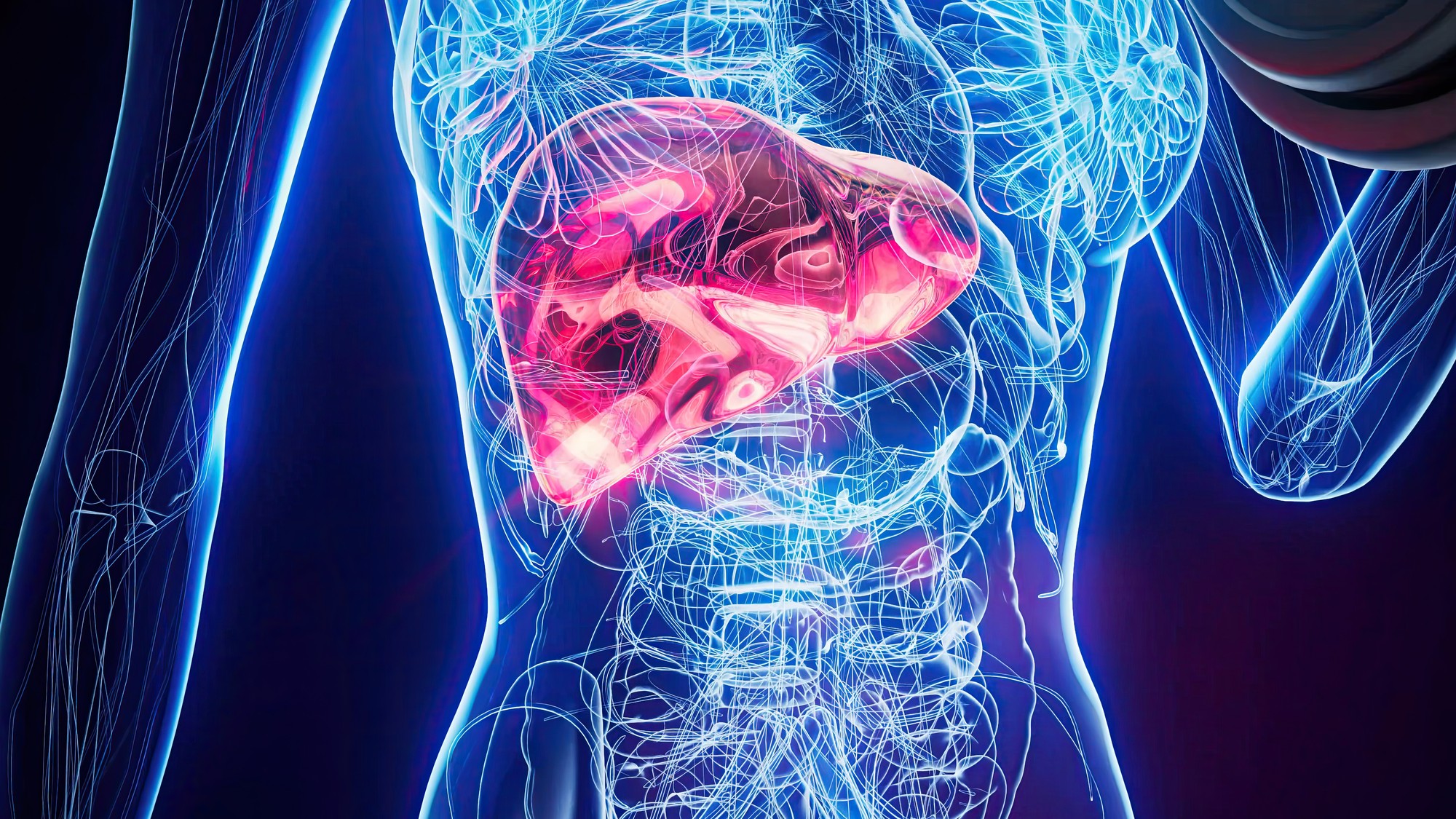 Pečeň je jedným z najdôležitejších orgánov v tele a zohráva kľúčovú úlohu pri detoxikácii aj metabolizme.
