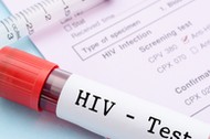 HIV