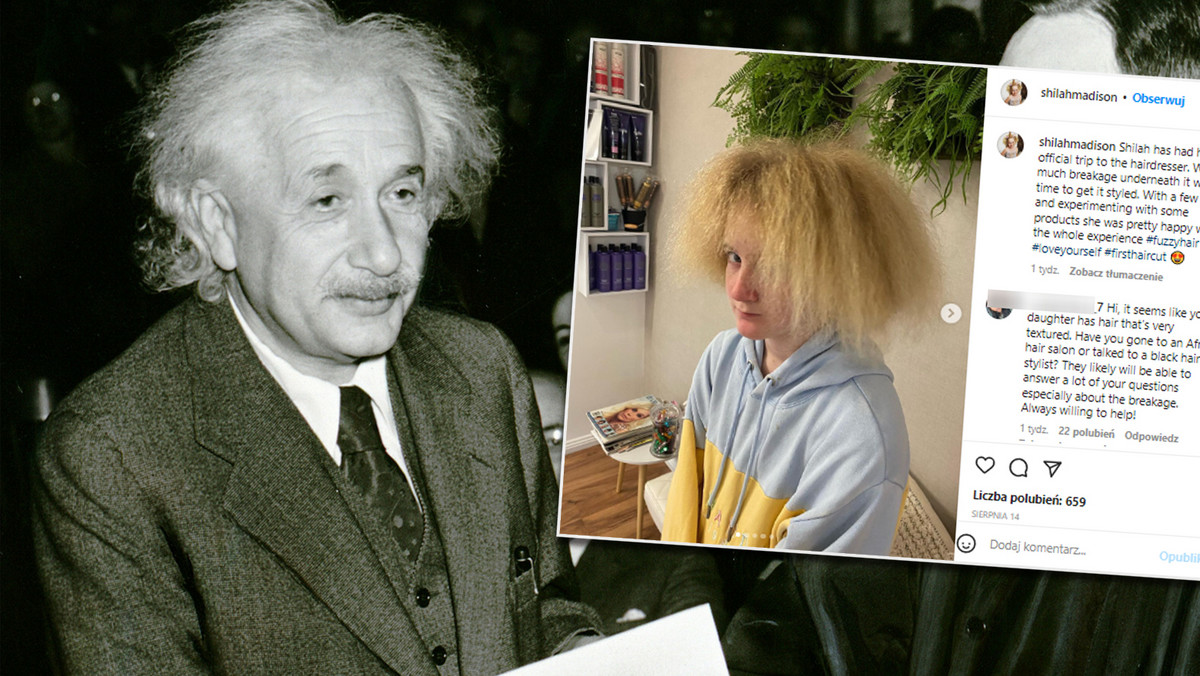 Dziewczynka z włosami Einsteina jest już nastolatką. Zobacz, jak wygląda
