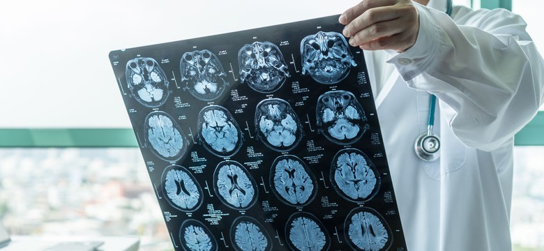 Operacje mózgu przy użyciu sztucznej inteligencji? Tak! Możliwe już za dwa lata
