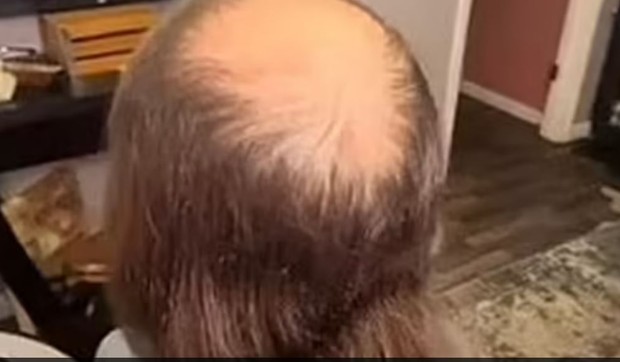 Neverovatna transformacija