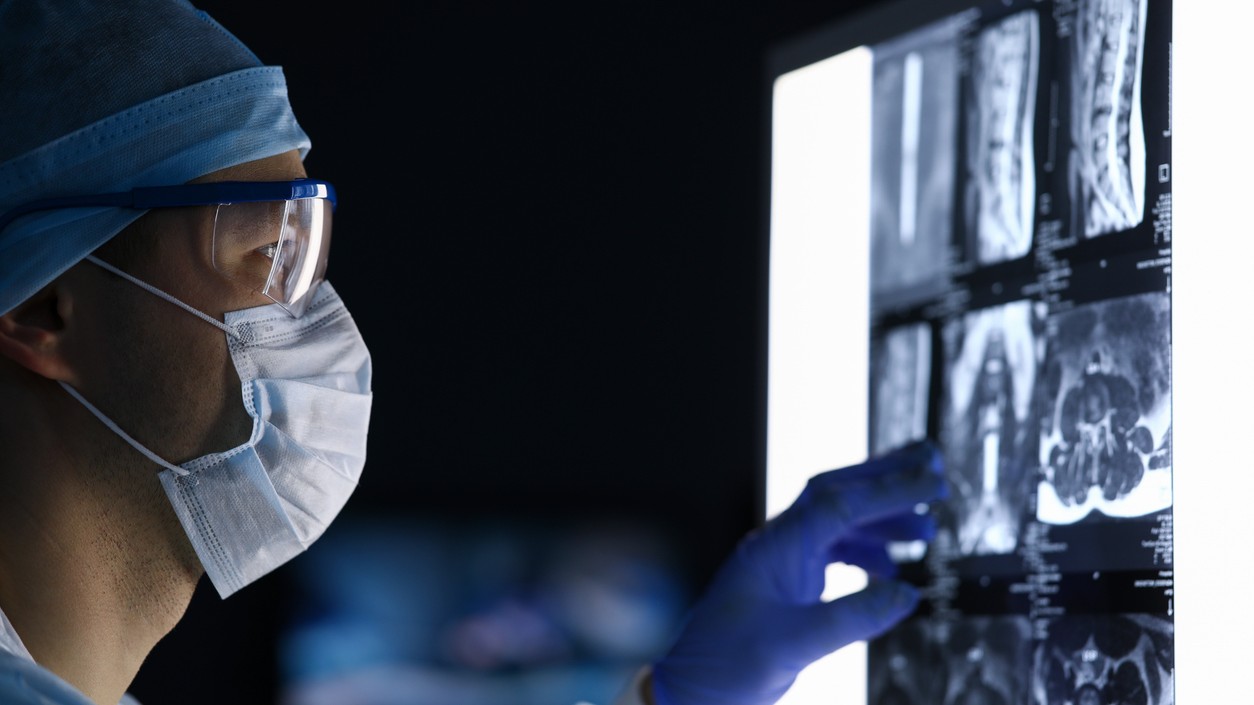 Príznaky, ktoré žena považovala za menopauzu, boli v skutočnosti prejavom zriedkavej a agresívnej rakoviny.(ilustračné foto).