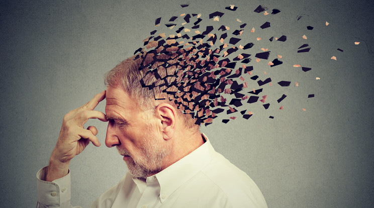 Úgy vélik, az Alzheimer-kór kialakulásában is szerepet játszhat a cukorban, zsírban gazdag táplálkozás /Fotó: shutterstock