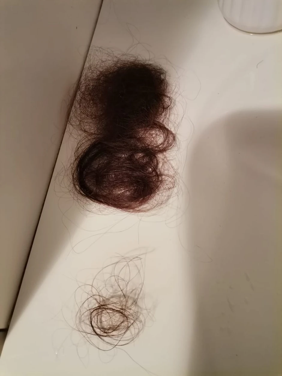 Dunjina kosa nakon preležanog virusa - gornja hrpa kose je količina koja je opadala prilikom svakog pranja tokom mesec dana, a donja je posle nedavnog pranja.