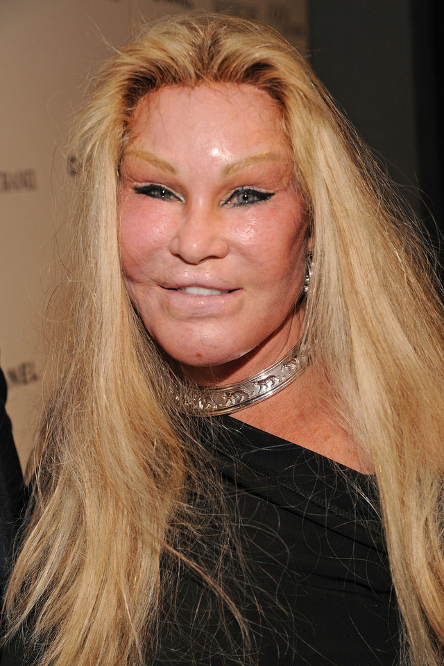 Twarz wielbicielki operacji plastycznych Jocelyn Wildenstein szokuje i przeraża każdego