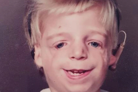 Zbog DEFORMISANOG LICA majka ga je napustila ČIM SE RODIO: Nije mogla da ga gleda, a OVO JE ON danas - oženio se i dobio DVOJE DECE, pa pokucao na vrata BIOLOŠKIH RODITELJA