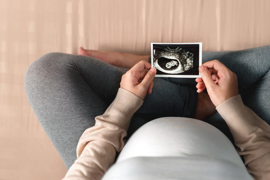 Pedig azt mondták, nem lehet gyermeke Fotó: Getty Images