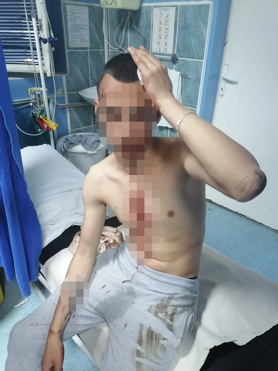 Pretučen mladić u Smederevu