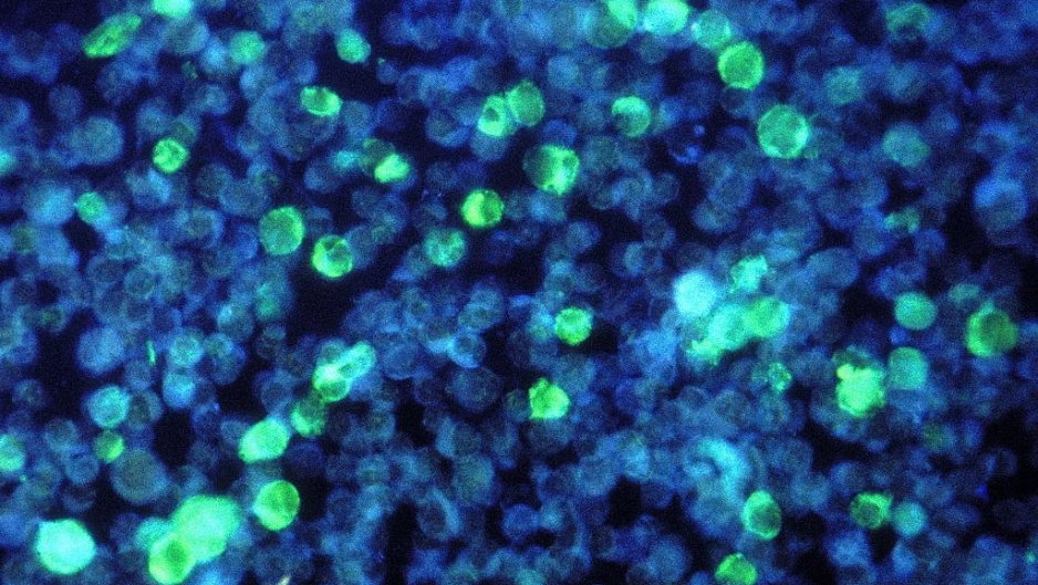 Obraz mikroskopowy wirusa Epsteina-Barr (fot. Getty Images)