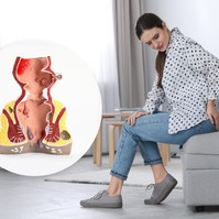 Előrehaladott aranyér: tünetek, amik már a 4. stádiumra utalnak