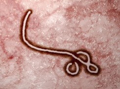 Wirus Ebola wrócił do Wybrzeża Kości Słoniowej po 27 latach