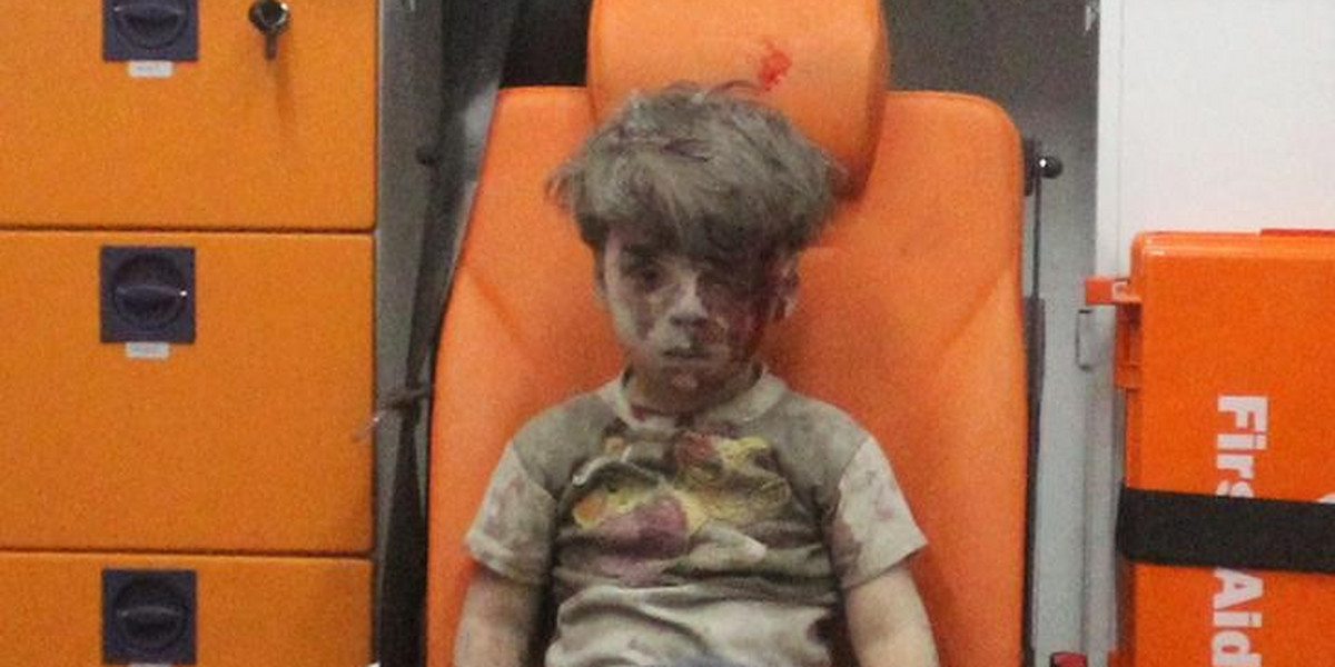 Assad's propaganda hits new low: Photo of Syrian boy harmed in airstrike was 'manipulated'