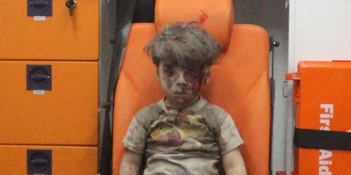 Assad's propaganda hits new low: Photo of Syrian boy harmed in airstrike was 'manipulated'