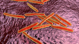 Gruźlica. Ta choroba wciąż może być śmiertelna [INFOGRAFIKA]