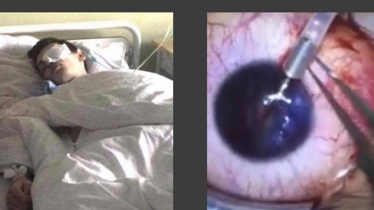 Rafał Adamczyk ze Stalowej Woli walczy o swoje zdrowie. Zbiera na kosztowne leczenie gałki ocznej. Wszystko przez wypadek, do którego doszło w maju 2016 roku. W trakcie zajęć na strzelnicy nastolatek został trafiony w oko.