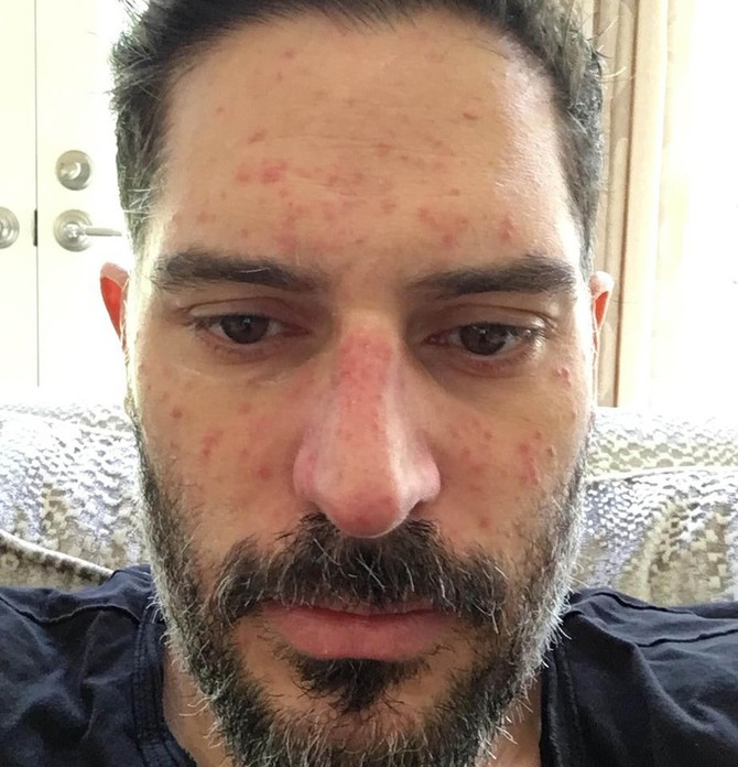Džo Manganijelo 