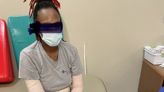 Przez COVID straciła dłonie i nogi. Lekarz publikuje poruszające zdjęcia i apeluje do niezaszczepionych