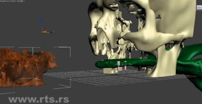 Rekonstrukcija vilice