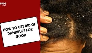 How to get rid of dandruff for good