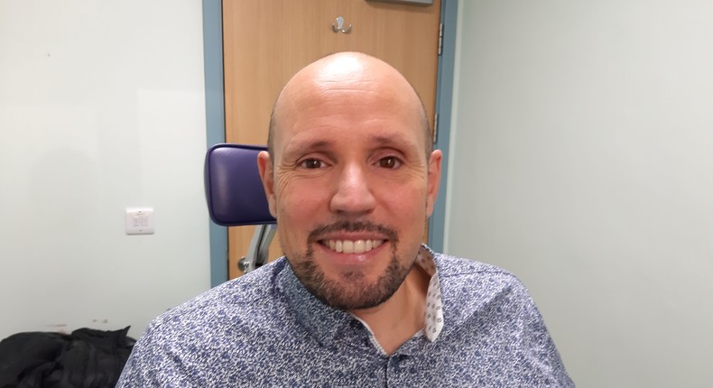 Steven Verze pictured with his 3D-printed prosthetic eye.