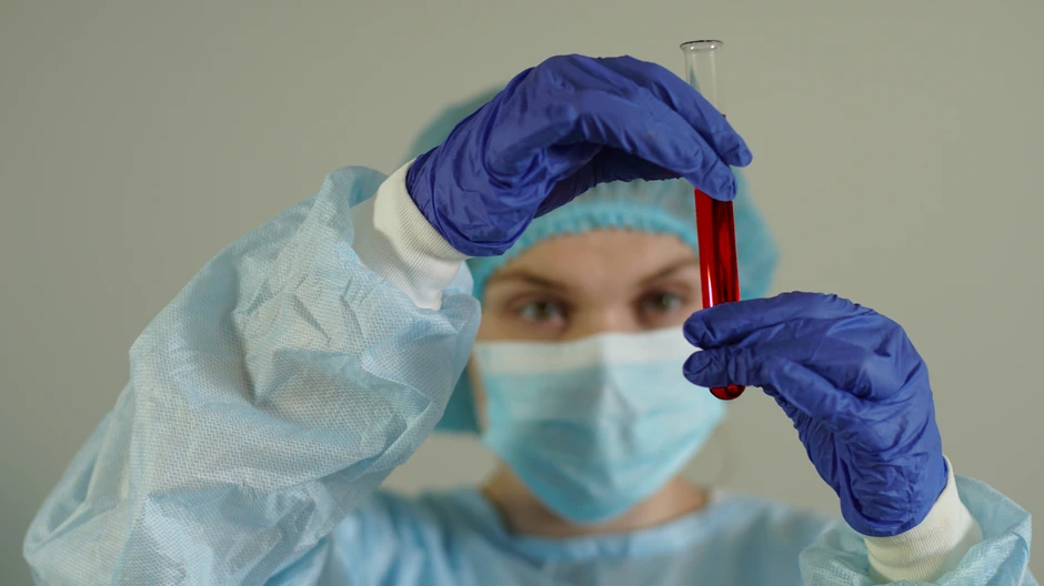 Visok MCHC se naziva hiperhromija, a nizak hipohromija