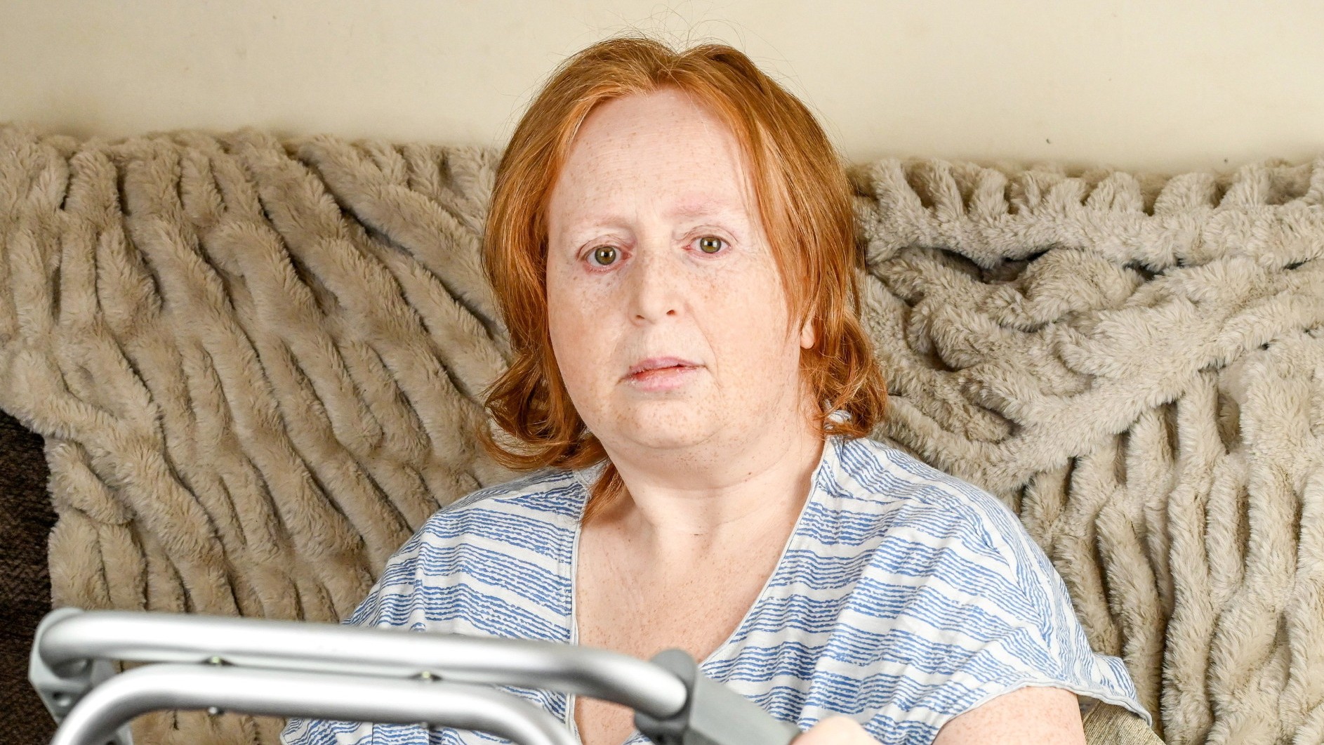 Samantha má po liečbe vážne zdravotné problémy. 