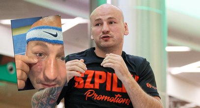 Artur Szpilka ucierpiał podczas sparingu. Skutki dalej widać. "Masakra"