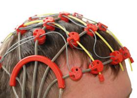 Hogyan vizsgálható az agyműködés? Az EEG titkai | EgészségKalauz