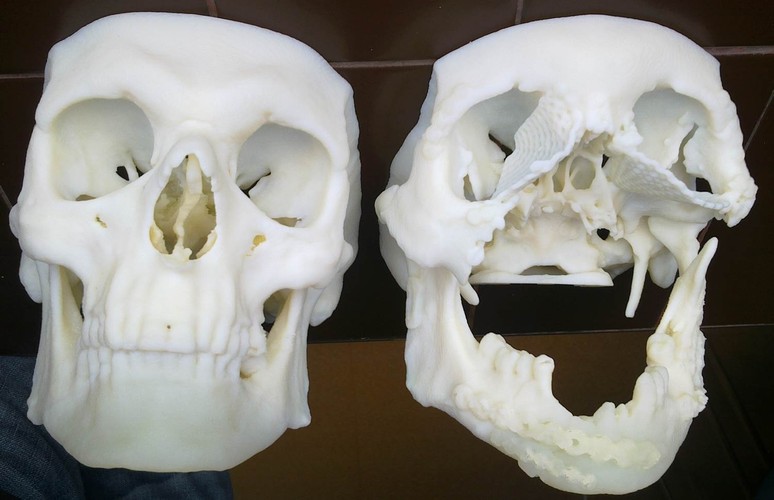 Pierwszy w Polsce przeszczep twarzy