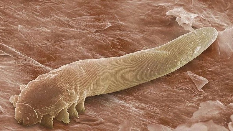 Nużeniec ludzki (Demodex folliculorum)