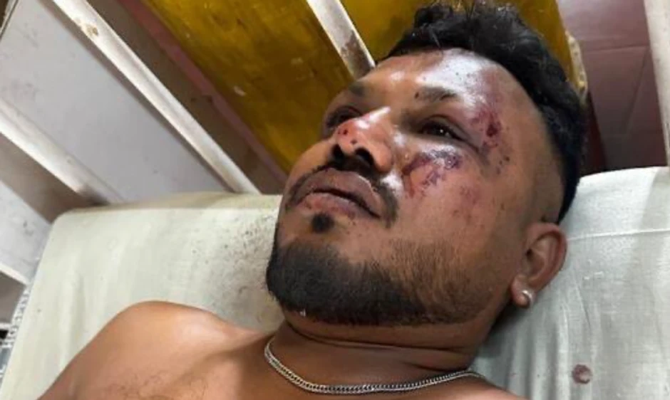 Jedini preživeli putnik avionske nesreće u Indiji - Višvaš Kumar Rameš