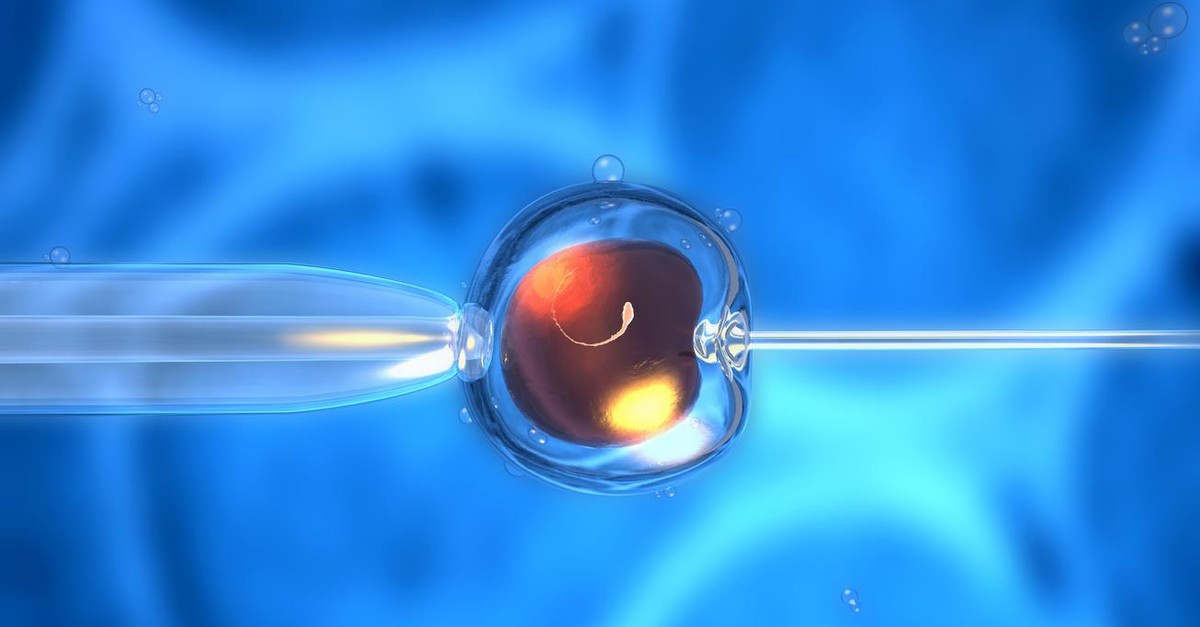 Narząd W Którym Dochodzi Do Zapłodnienia Jak przebiega zapłodnienie in vitro?