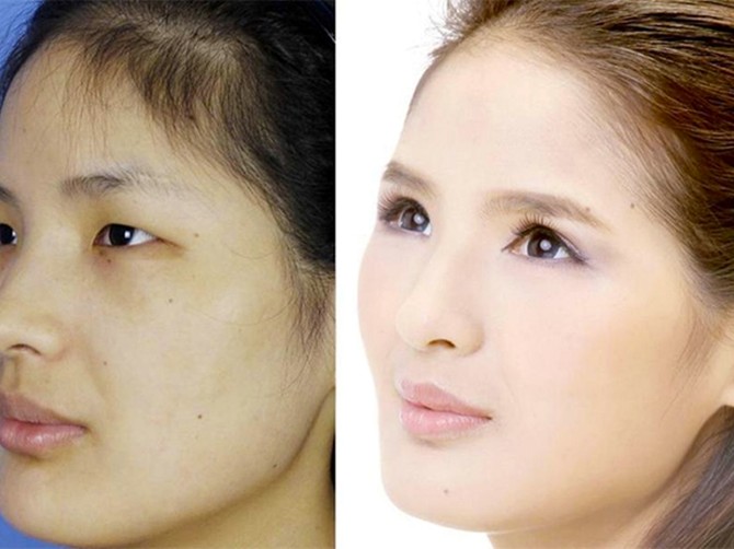 75760_plasticsurgeryba23