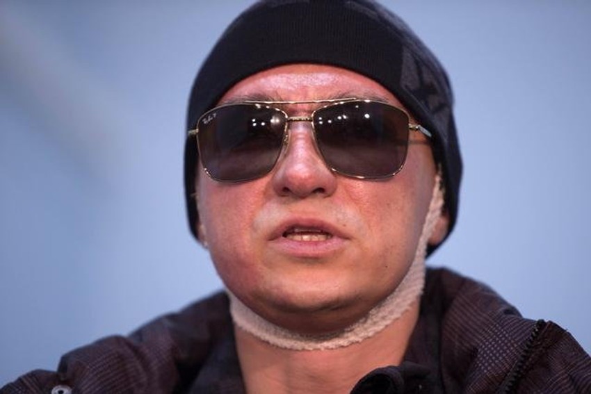 Sergej Filin posle napada