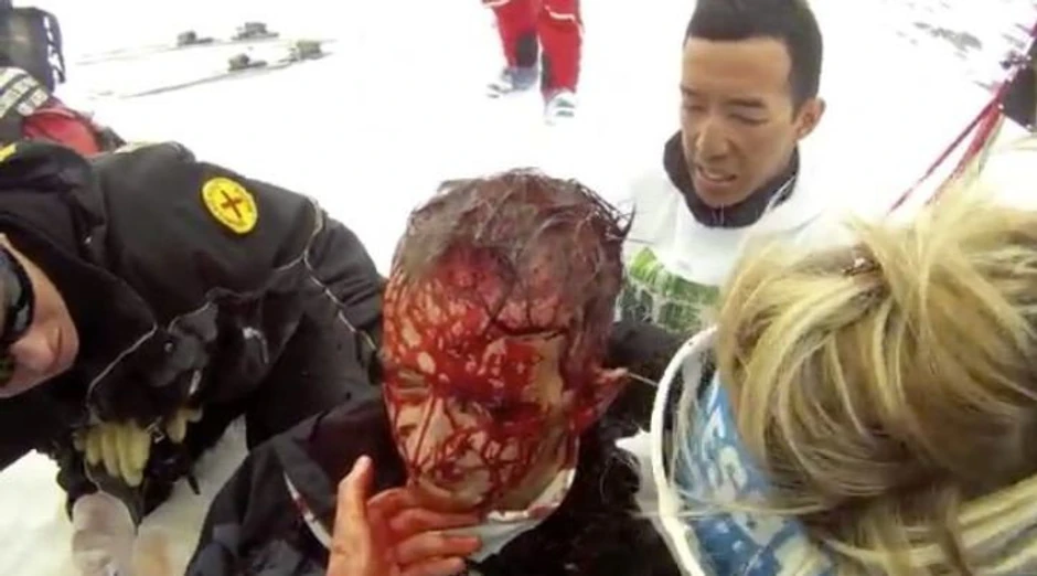 Obliveno krvlju, lice mu je izgeldalo užasno