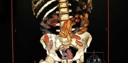 Nigeryjczyk zatrzymany. Nie uwierzysz, co miał w brzuchu!