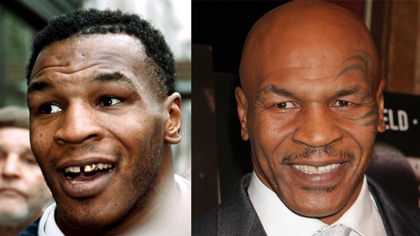 Mike Tyson