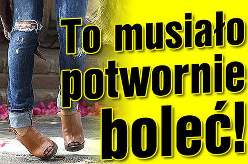 To musiało potwornie boleć!